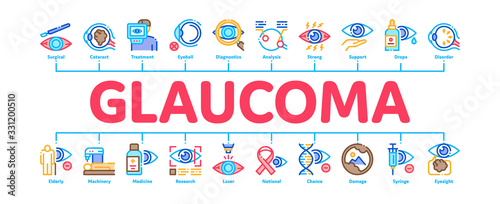 Glaucoma Ophthalmology Minimal Infographic Web Banner Vector. Glaucoma Disease Symptoms And Treatment Eye Drop And Medical Equipment Illustrations