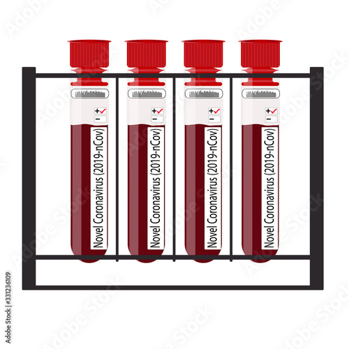 Microbiological blood sample many others test tubes exam analysis hospital results show positive for Novel Coronavirus (2019-nCoV) vector illustration