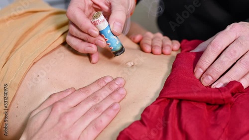 Alternative therapist applying moxibustion a traditional chinese medicine method .  photo