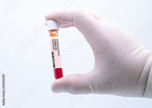 Coronavirus positive blood test. Coronavirus covid-19 outbreaking. Epidemic virus Respiratory Syndrome. Pharmaceutical & genetics Research Centre. photo