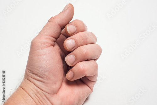 Close- up of long nails. Brittle nails on your finger