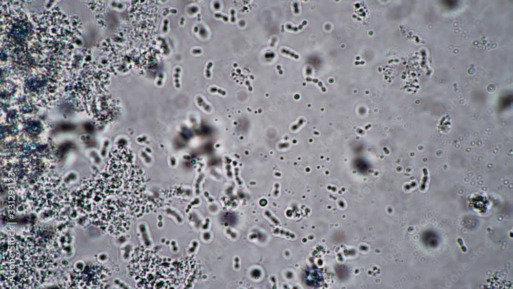 Adjusting the focus of the microscope on lacto bacteria and bacilli. Theme of lactic acid foods is under 1000x magnification. Bacteria useful for human body from yogurt. Microcosmic background