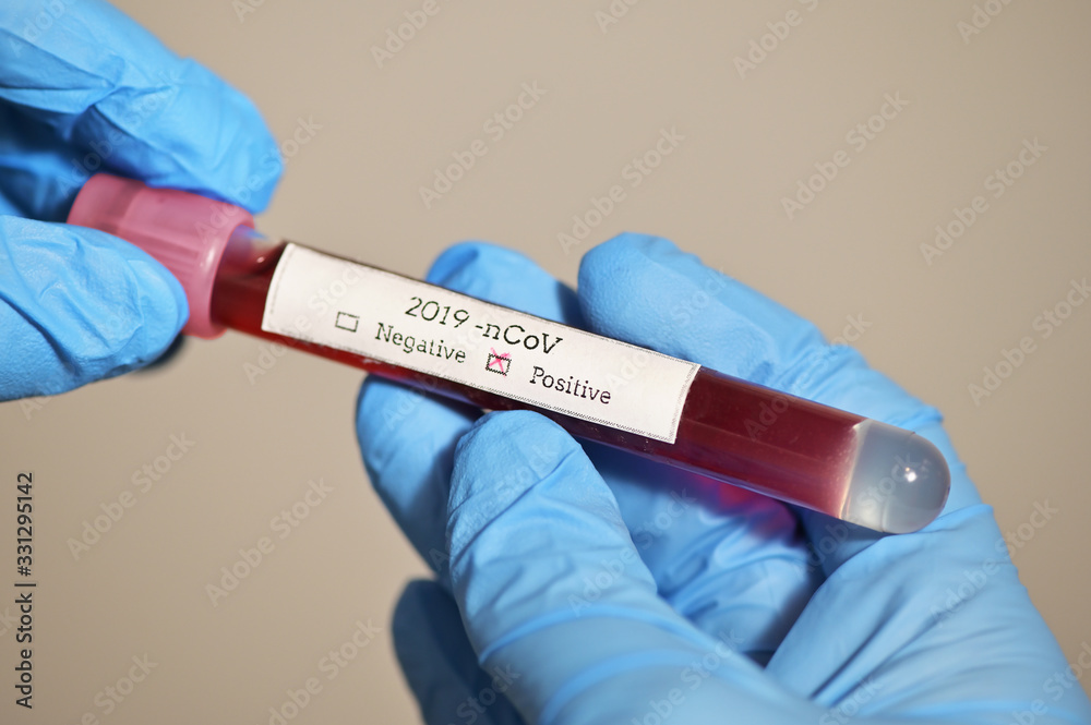 Fototapeta premium Coronavirus 2019-Ncov With Blood Test
