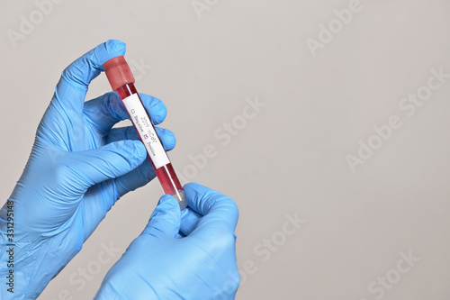 Coronavirus 2019-Ncov With Blood Test