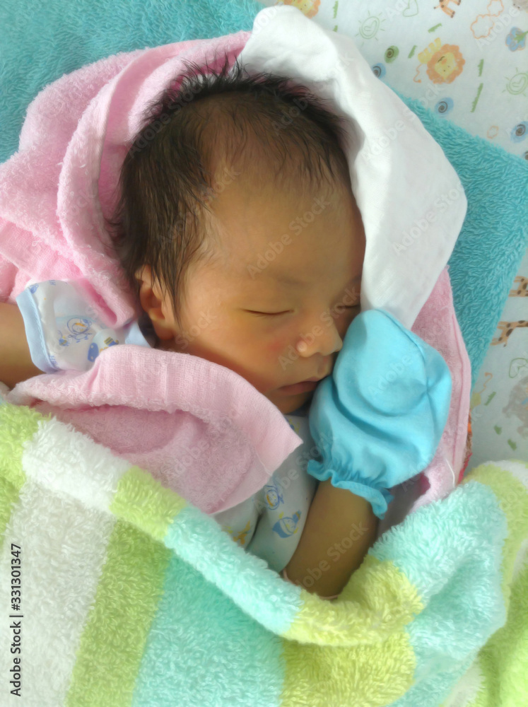 neonatal jaundice or hyperbilirubinemia on infant boy case of yellow