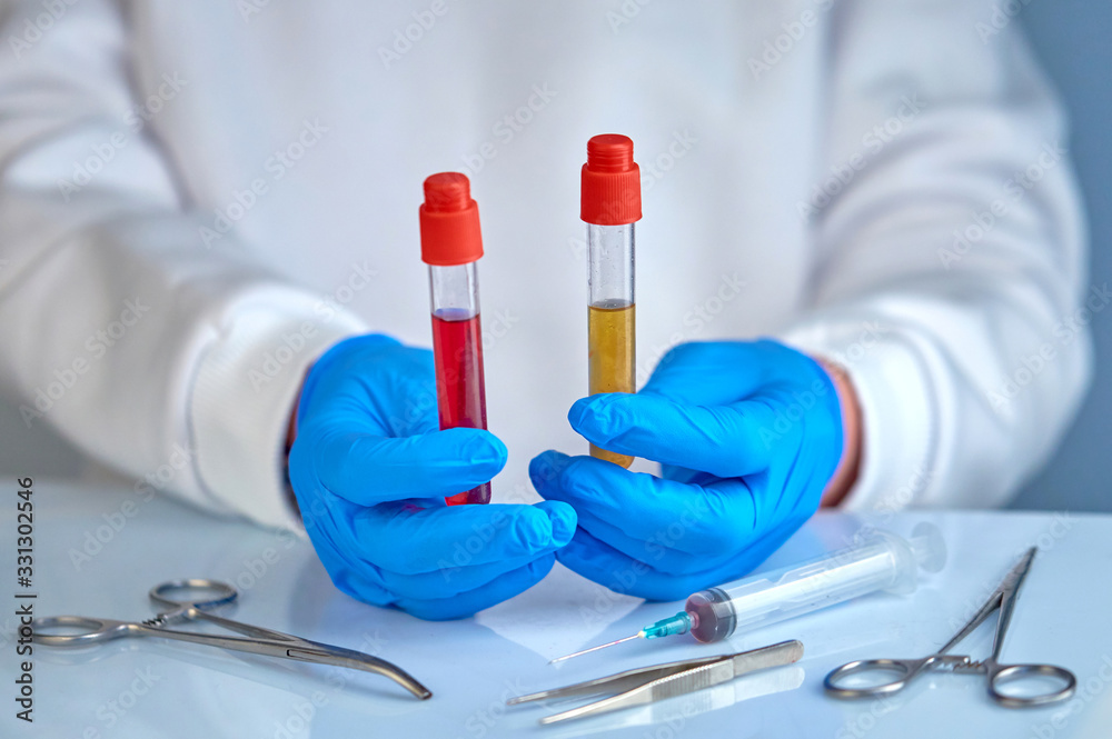 Doctor holding blood test tubes, coronavirus COVID19, HIV, SARS, ebola conceptual background Doctor holding blood test tubes, coronavirus COVID19, HIV, SARS, ebola conceptual background