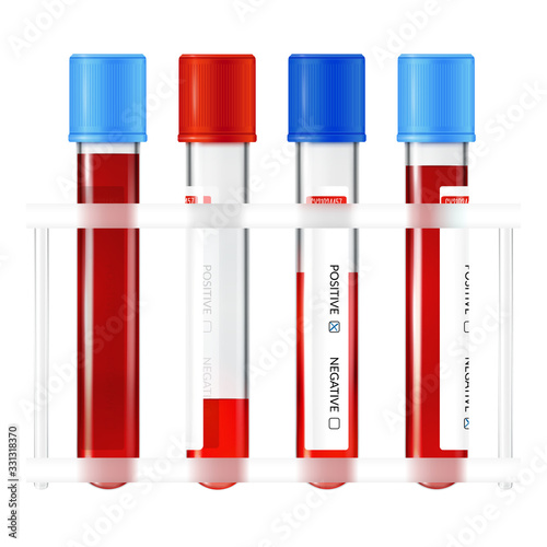 Medical test tubes with samples of blood taken. Vector illustration on a white background