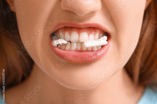 Young woman with chewing gu...