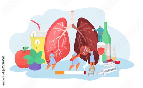 Lungs desease with doctors medical concept of pneumania illness diagnosis and treatment vector illustration. Huge human ill lungs and mini medics. Pulmonary deseases medicine concept.
