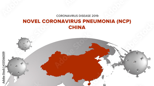 Coronavirus Disease 2019: Novel Coronavirus Pneumonia (NCP) Italy