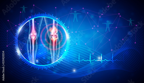 Knee joint damage and treatment concept on an abstract blue background