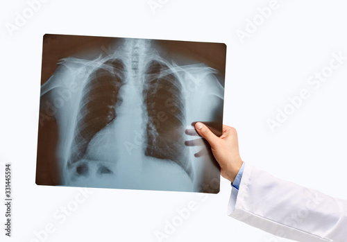 Obraz na plátně Man hand holding a lungs radiography isolated on a white background