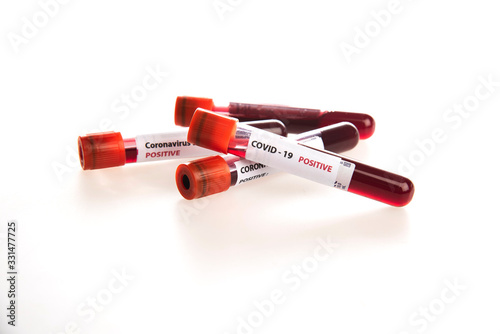 coronavirus Covid-19 blood test sample tubes isolated 
