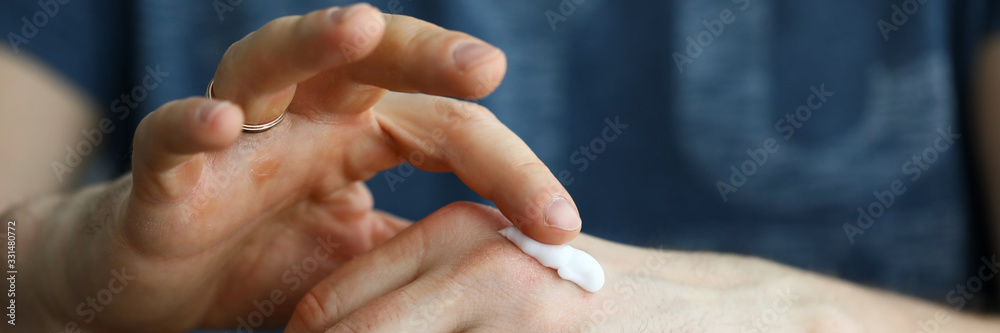 Fototapeta premium Male hands applying moistening cream on skin