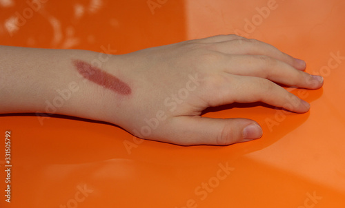 Wallpaper Mural There's a Curling iron burn on my arm. Child's wound Torontodigital.ca