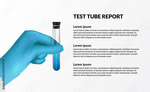 Sample blue liquid for laboratory testing analysis. sterile glove hand holding Test tube medical check up report.