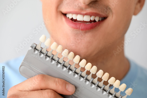 Man with teeth color samples on light background, closeup