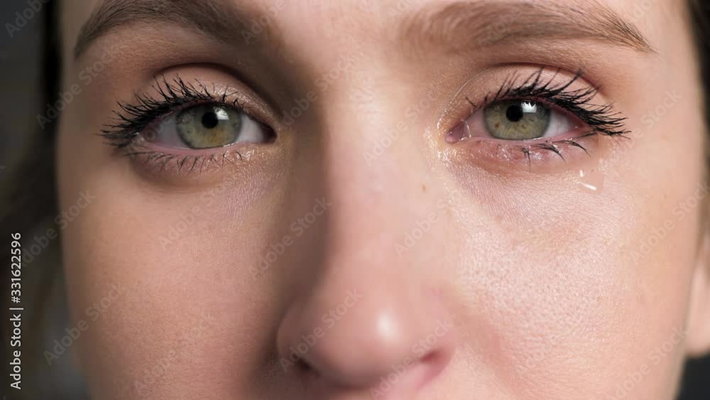 Watery eyes. Woman cries and looking at camera, flu, tonsillitis, colds