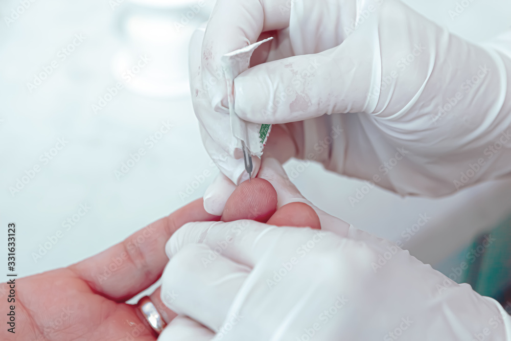 Fototapeta premium A blood test is a laboratory analysis performed on a blood sample that is usually extracted from a vein in the arm using a hypodermic needle, or via fingerprick. Modern hospital hematology laboratory.