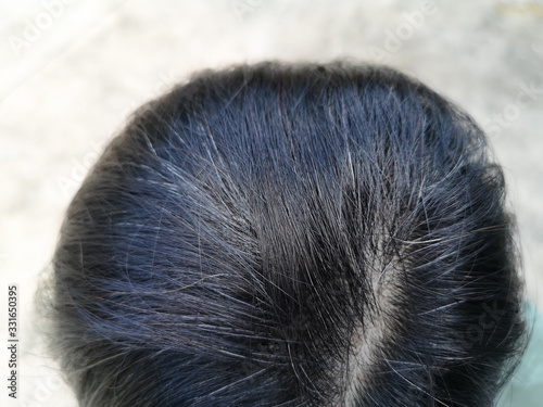 Premature gray hair Asian people are caused by stress.