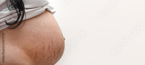 Foto stretch marks on pregnant belly, skin care concept, panoramic mock-up