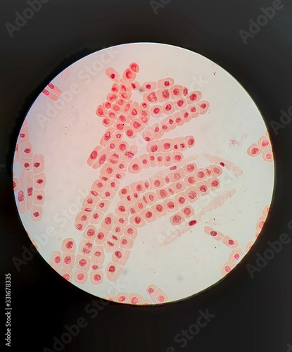 The mitosis cell of root tip onion under the light microscope. The cells were zoomed 40x. photo