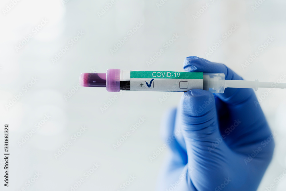 Obraz premium Positive medical result of coronavirus