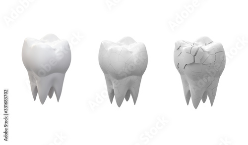 Broken molars tooth and whole tooth isolated on white background