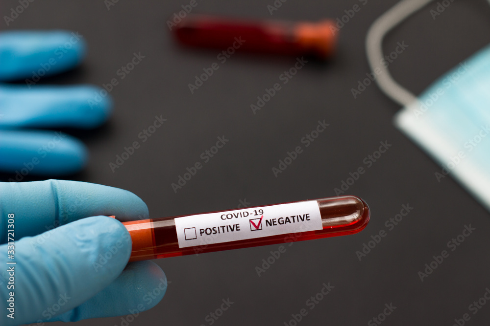 Obraz premium blood test tube to examine the corona virus
