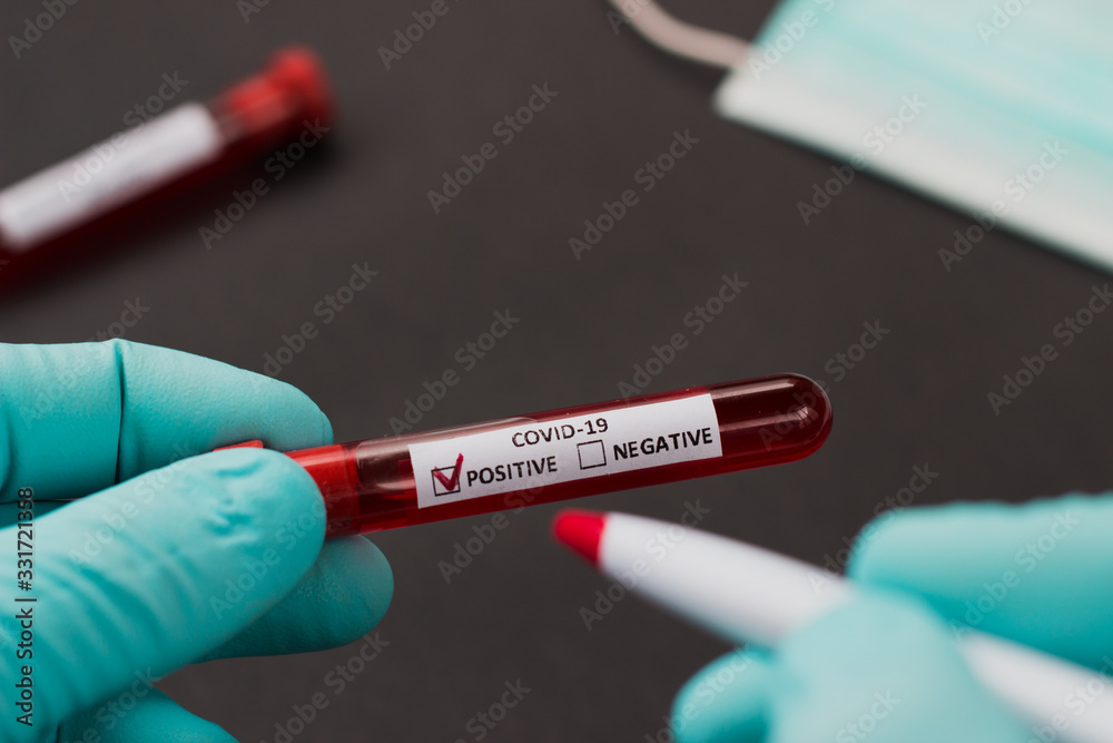 blood test tube to examine the corona virus