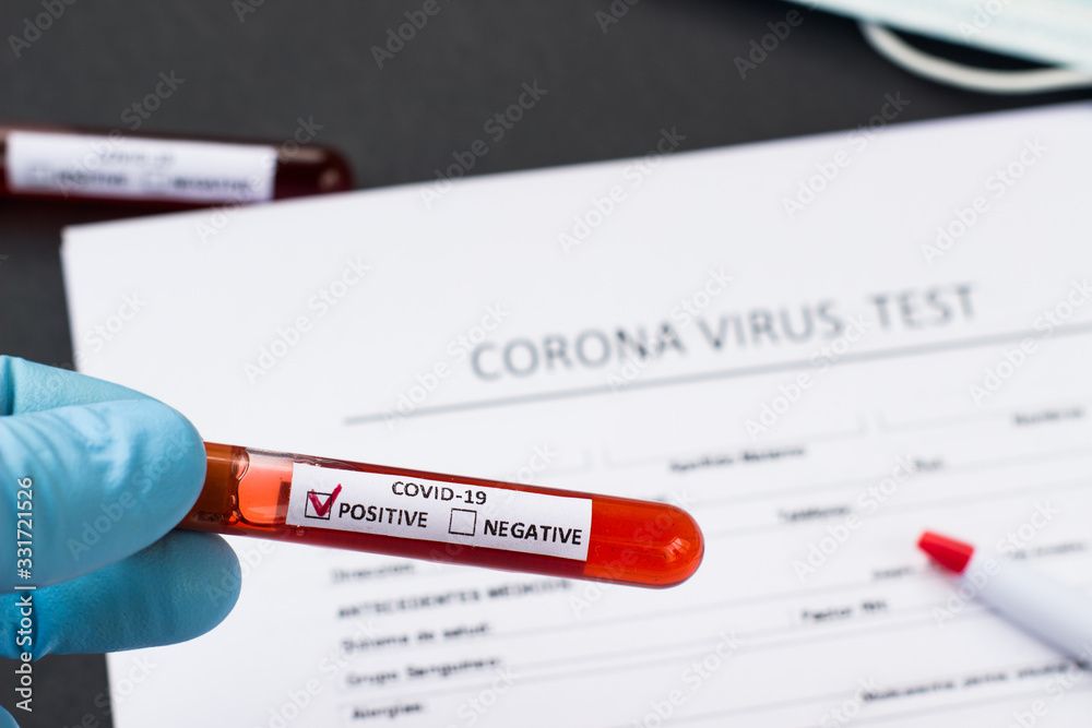 Obraz premium blood test tube to examine the corona virus