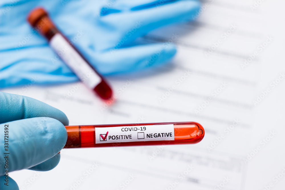 Fototapeta premium blood test tube to examine the corona virus
