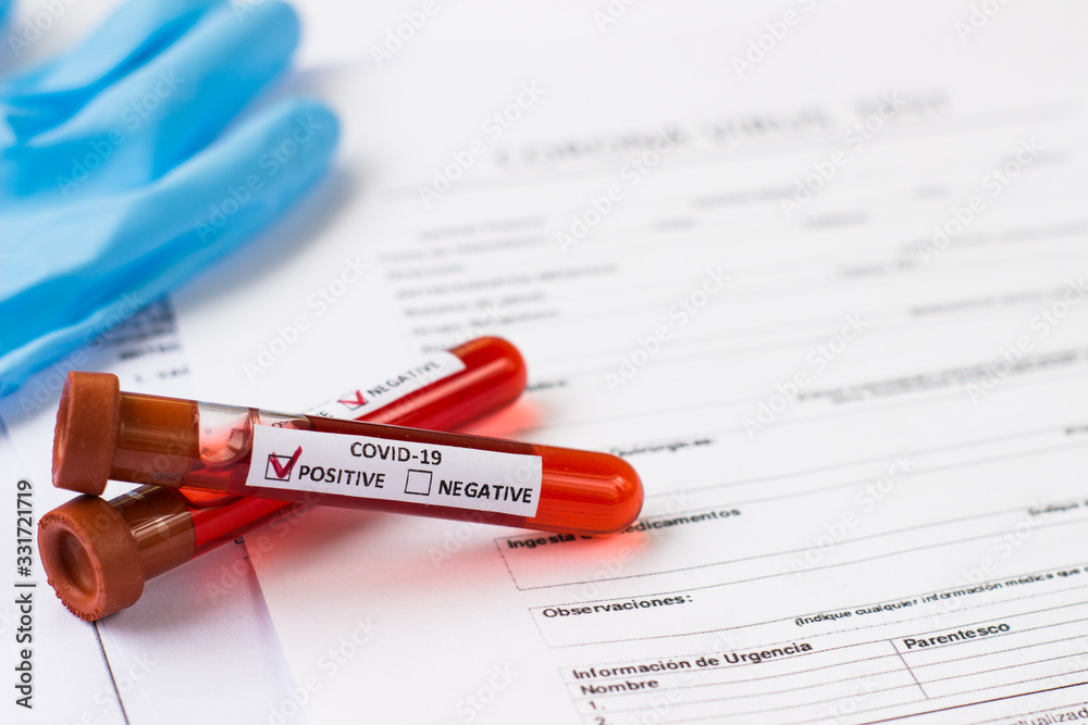 Obraz premium blood test tube to examine the corona virus