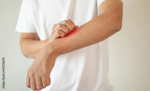 man itching and scratching on arm from itchy dry skin eczema dermatitis © Kwangmoozaa