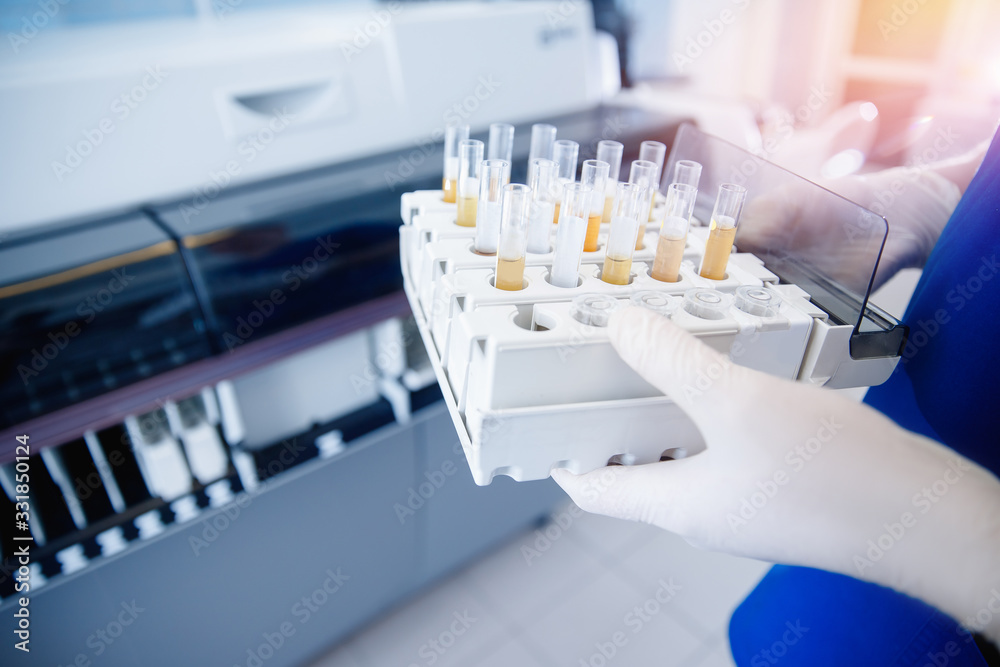 Nurse microbiologist holding test tube with blood for coronavirus 2019-nCoV analyzing