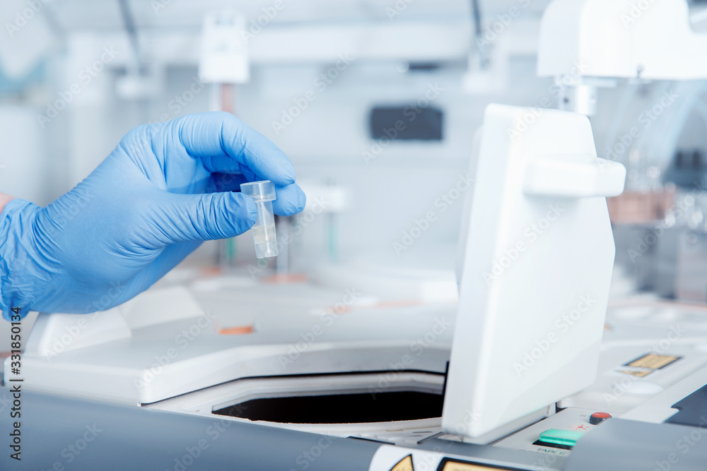 Express analysis of human saliva in medical laboratory Express analysis of human saliva in medical laboratory