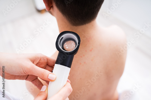 Doctor Examining Pigmented Skin