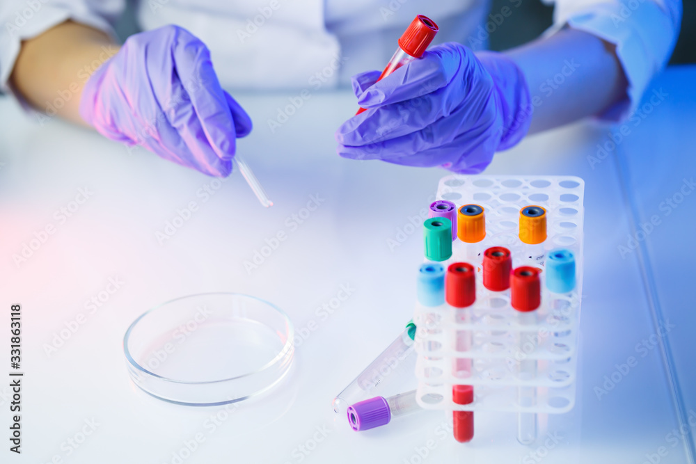 A medical professional, laboratory assistant, doctor performs an analysis in a laboratory, uses test tubes, a pipette and a petri dish for the presence of bacteria in the human body A medical professional, laboratory assistant, doctor performs an analysis in a laboratory, uses test tubes, a pipette and a petri dish for the presence of bacteria in the human body