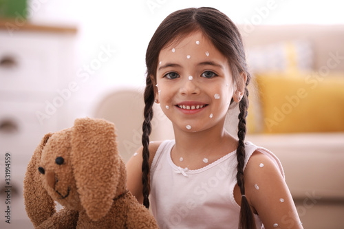 Little girl with chickenpox playing at home photo