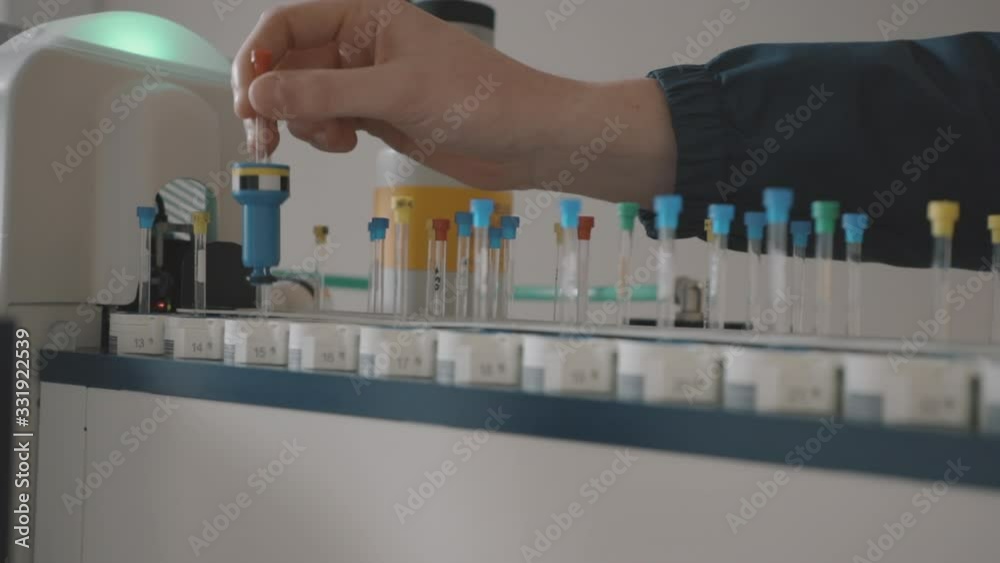 Epidemiologist conducting research for coronavirus vaccine. Closeup on the hand of a man working with tubes in the laboratory. Epidemiologist conducting research for coronavirus vaccine. Closeup on the hand of a man working with tubes in the laboratory.