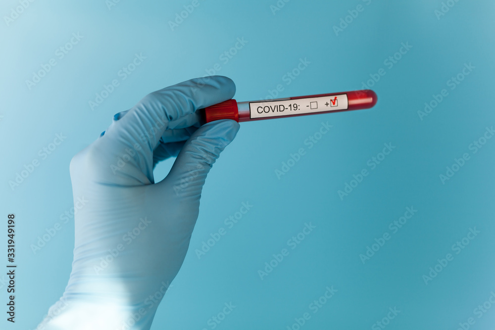 Fototapeta premium Positive blood test result for the new rapidly spreading Coronavirus