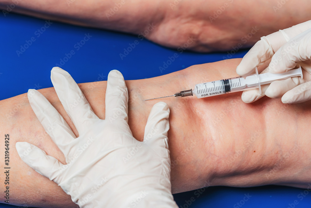 Injections into the veins of an elderly woman's leg closeup. Doctor's injections in the veins