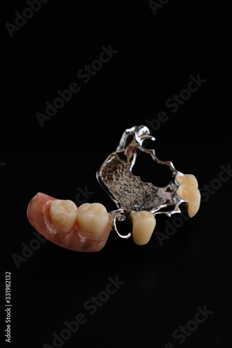 Dental appliances and dental prostheses.