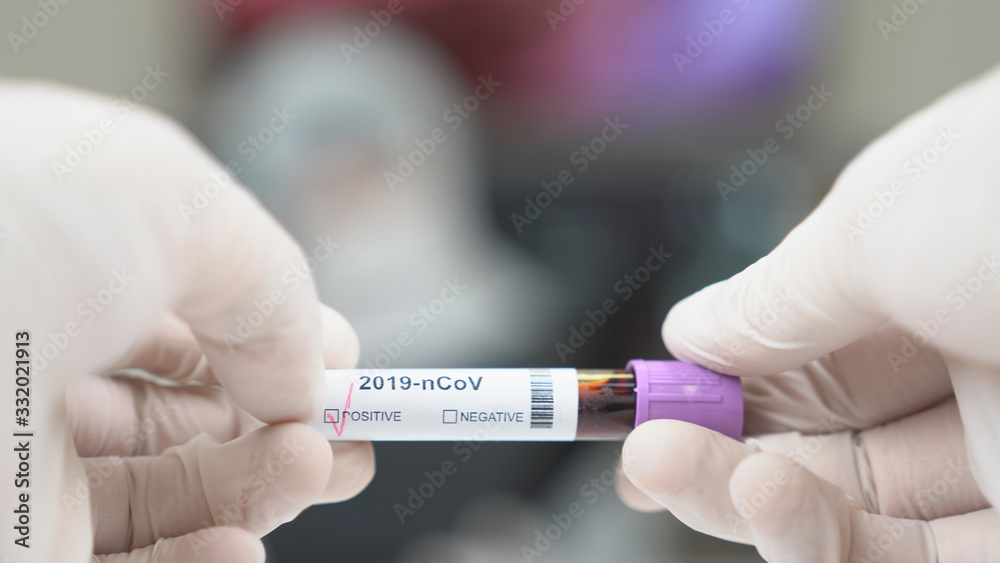 Coronavirus test tubes, flasks in laboratory with scientist background. Coronavirus test tubes, flasks in laboratory with scientist background.