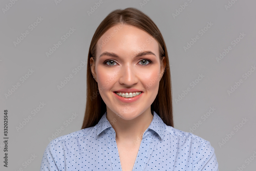 Beautiful girl smiling and surprised, white teeth with braces. Dental care. Beauty happy woman smile with orthodontic accessories. Cosmetic dentistry, orthodontics treatment. Beautiful girl smiling and surprised, white teeth with braces. Dental care. Beauty happy woman smile with orthodontic accessories. Cosmetic dentistry, orthodontics treatment.