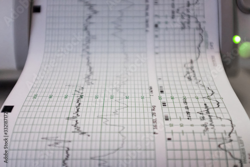 Wallpaper Mural A fetal echocardiography test. Modern Ultrasound Room at Hospital. Hospital Ward with Bed and Medical Equipment Torontodigital.ca