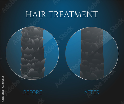 Damaged and healthy hair under the microscope. Hair follicle surface condition closeup before and after treatment. Trichology medical concept. Vector illustration.