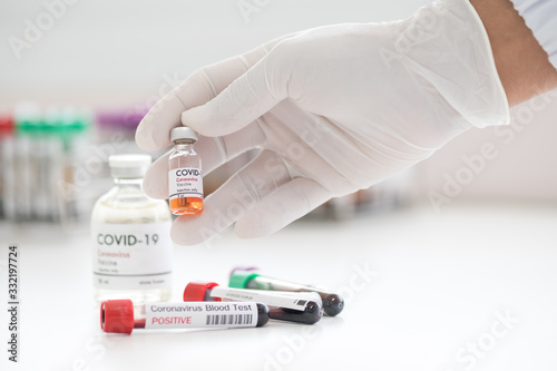 Blood test tube for laboratory analysis.Laboratory testing patient’s blood samples.Conceptual image coronavirus (COVID-19) test tube sample that has tested positive for coronavirus.