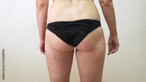Woman shacking her fat buttock with cellulite close up