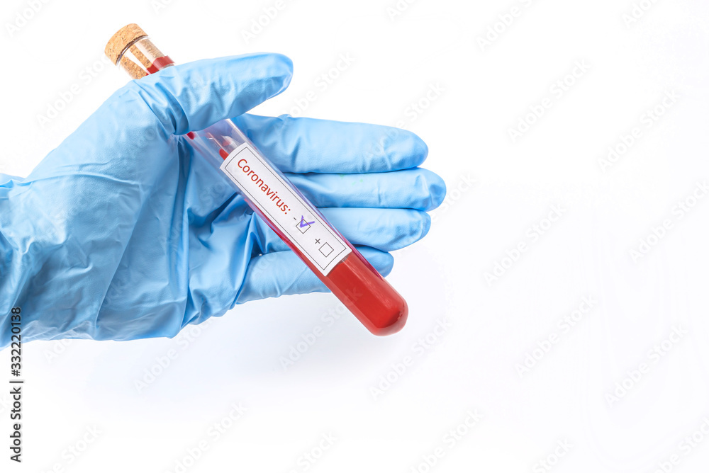 Test tube with blood sample Covid19 (coronavirus). Laboratory testing
